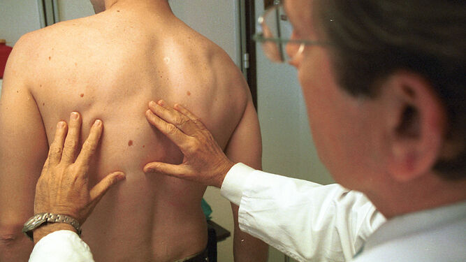 Especialistas animan a vigilar cualquier cambio que se produzca en el cuerpo y acudir al dermatólogo.