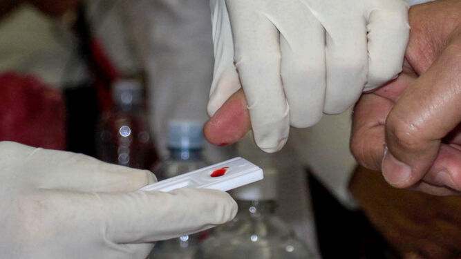 Una prueba de diagnóstico del VIH.