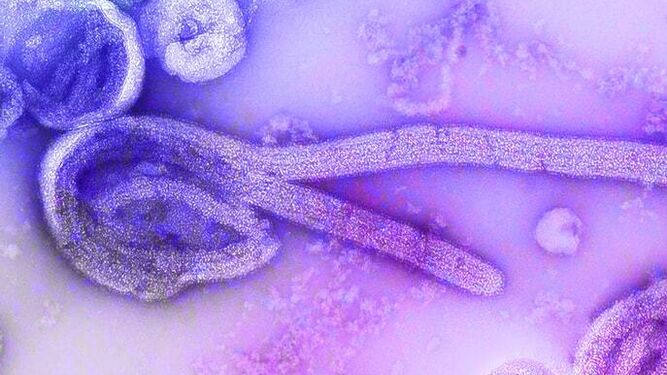 El virus del ébola