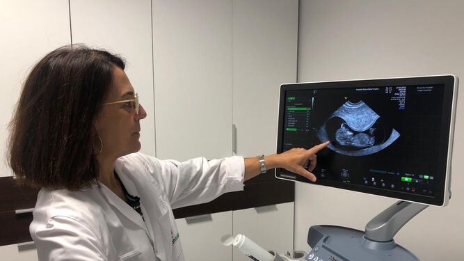 La doctora Encarna Santana Verano, ginecóloga del Hospital Quirónsalud Huelva.
