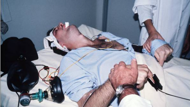Terapia electroconvulsiva:  ¿La esperanza definitiva para pacientes con trastornos mentales graves?